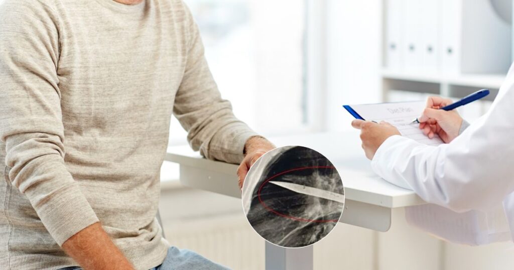 After the violent incident, the 44 year old healed and went back to normal until his nipple leaked. (Image Source: @kokchapress/X)