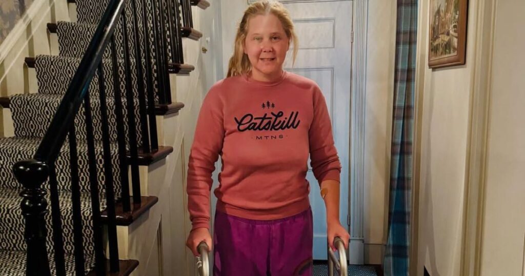 Amy Schumer Might Get Crippled for Life Due to Spinal Surgery