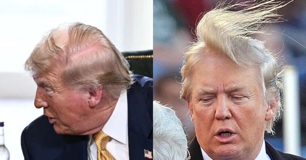 Donald Trump struggling to hide his receding hairline. ( left- @MeidasTouch|X) and (@AlecLuhn|X).