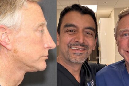 Gary has found a new life after plastic surgery