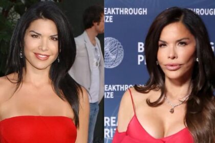 Lauren Sanchez before and after the alleged plastic surgery