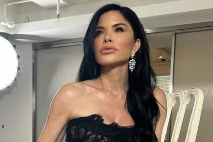 Lauren Sánchez Bezos overdone lip fillers