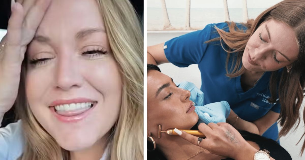 A women shared unexpected side effect of her trendy 'lip flip' cosmetic procedure on TikTok. (left- @samanthawlipedema/TikTok) and ( right- via sdbotox.com).