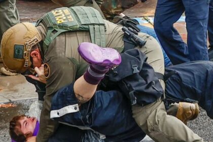 Elderly American Left With Broken Ribs After Border Patrol’s Violence