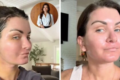 After a $78,000 full-cosmetic procedures, a Florida realtor reveals the emotional and physical toll of her painful recovery journey. (collage -pictures from Erica Wolfe|TikTok). ( Insert Image - @wolfeofrealestate|Instagram).