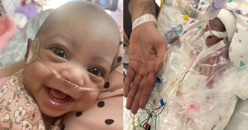 Cleveland mom’s preemie baby’s survival story
