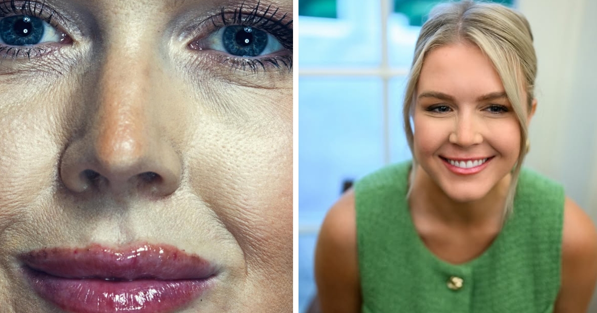 A glimpse of the Vanity Fair cover