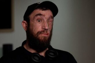 Pavlo Martsenyuk Blind Ukraine Soldier