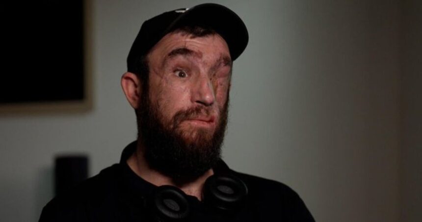 Pavlo Martsenyuk Blind Ukraine Soldier