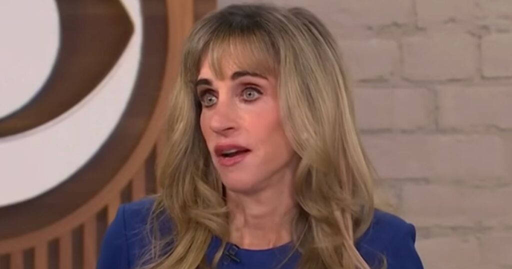 Susan Dell's before and after pictures online suggest she mostly had plastic surgery.