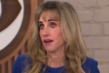 Susan Dell's before and after pictures online suggest she mostly had plastic surgery.