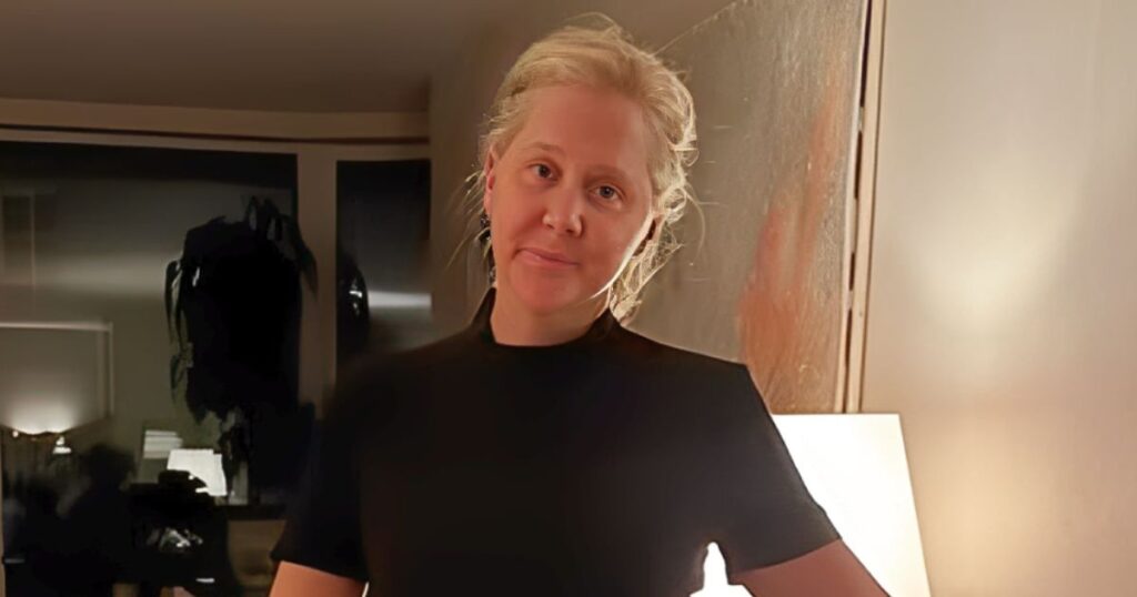 Amy Schumer shares unfiltered photos on Instagram after revealing a 50-pound weight loss