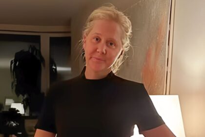 Amy Schumer shares unfiltered photos on Instagram after revealing a 50-pound weight loss