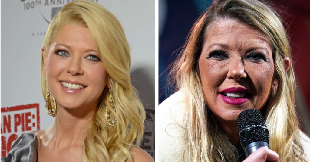 Tara Reid’s botched up plastic surgery and how it went down the wrong way