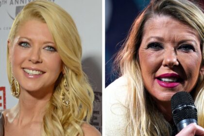 Tara Reid’s botched up plastic surgery and how it went down the wrong way
