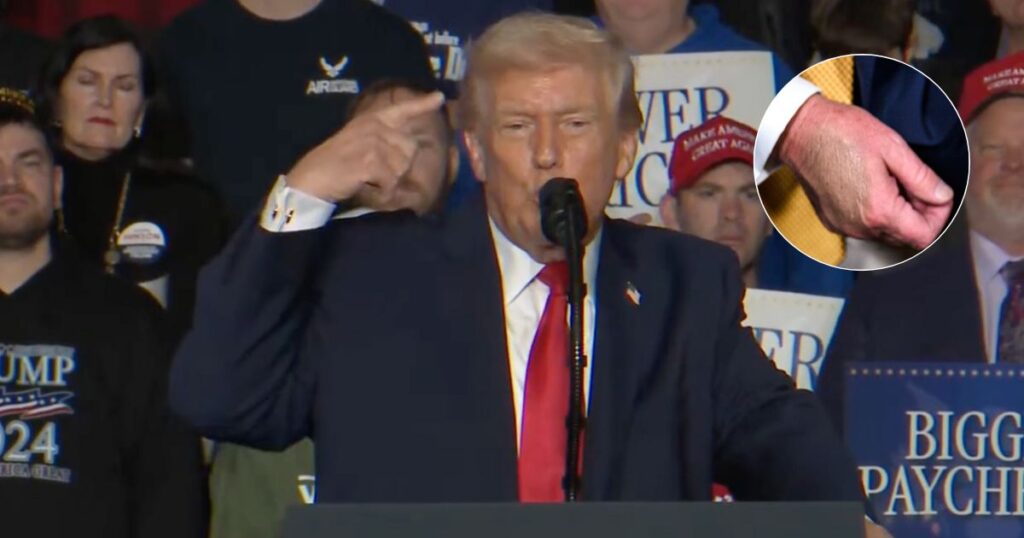 Donald Trump's bruised hand covered in makeup at Iowa sparks memes and health concerns once again.