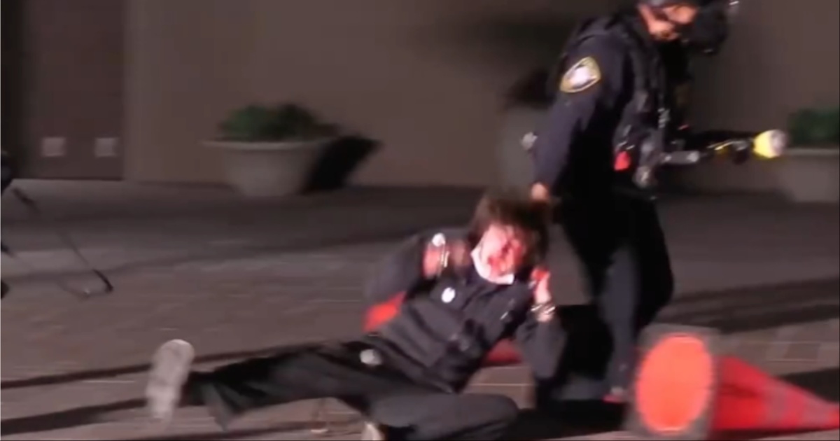 Protester says he was blinded by ICE