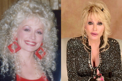 Fans surprised after seeing old images of Dolly Parton before cosmetic surgeries
