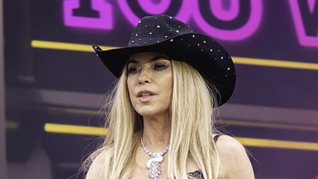 Shania Twain plastic surgery rumors.