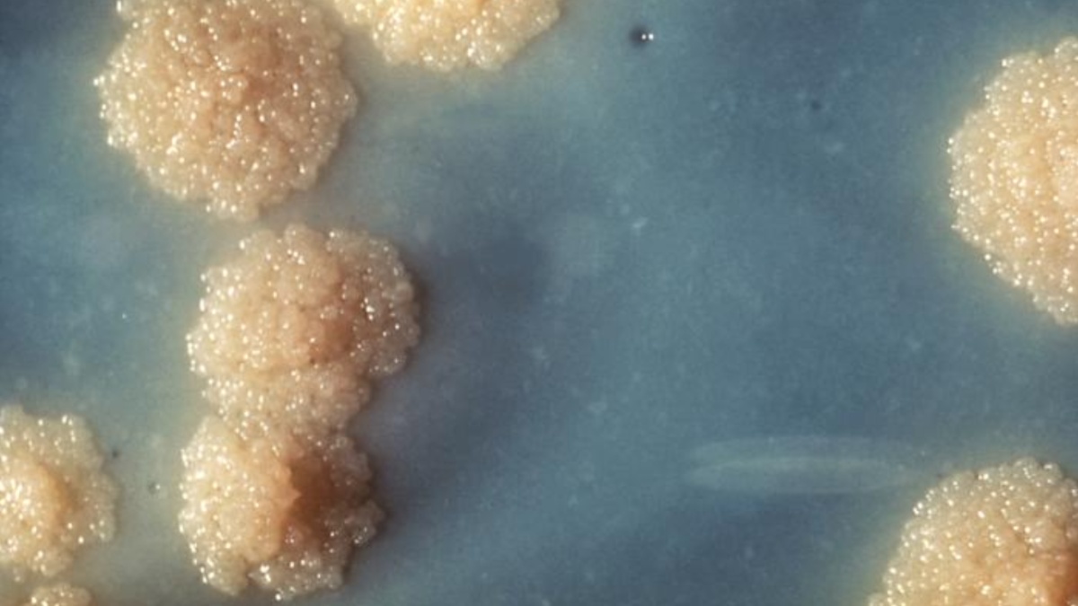 Experts Report Tuberculosis Cases Rising in U.S. Schools and Communities