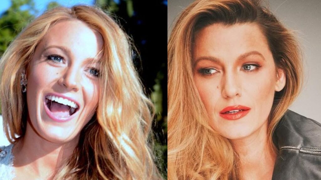 Blake Lively rhinoplasty
