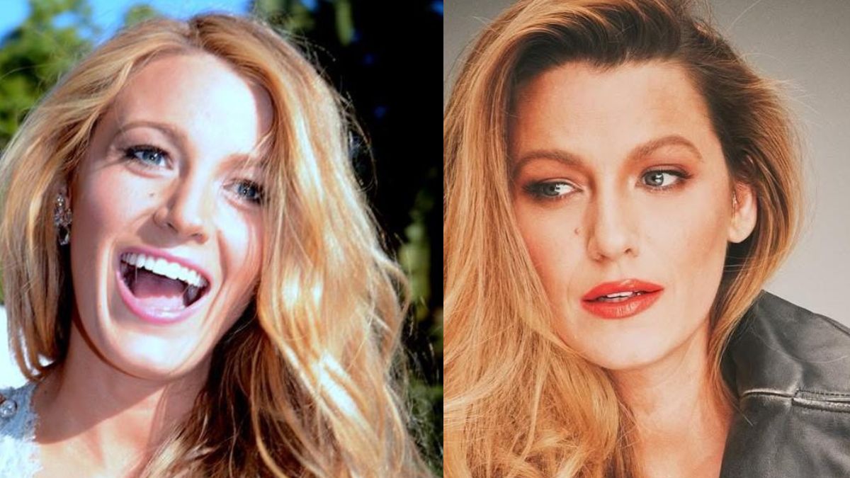 Cosmetic Expert Weighs In on Blake Lively’s Plastic Surgery Rumors