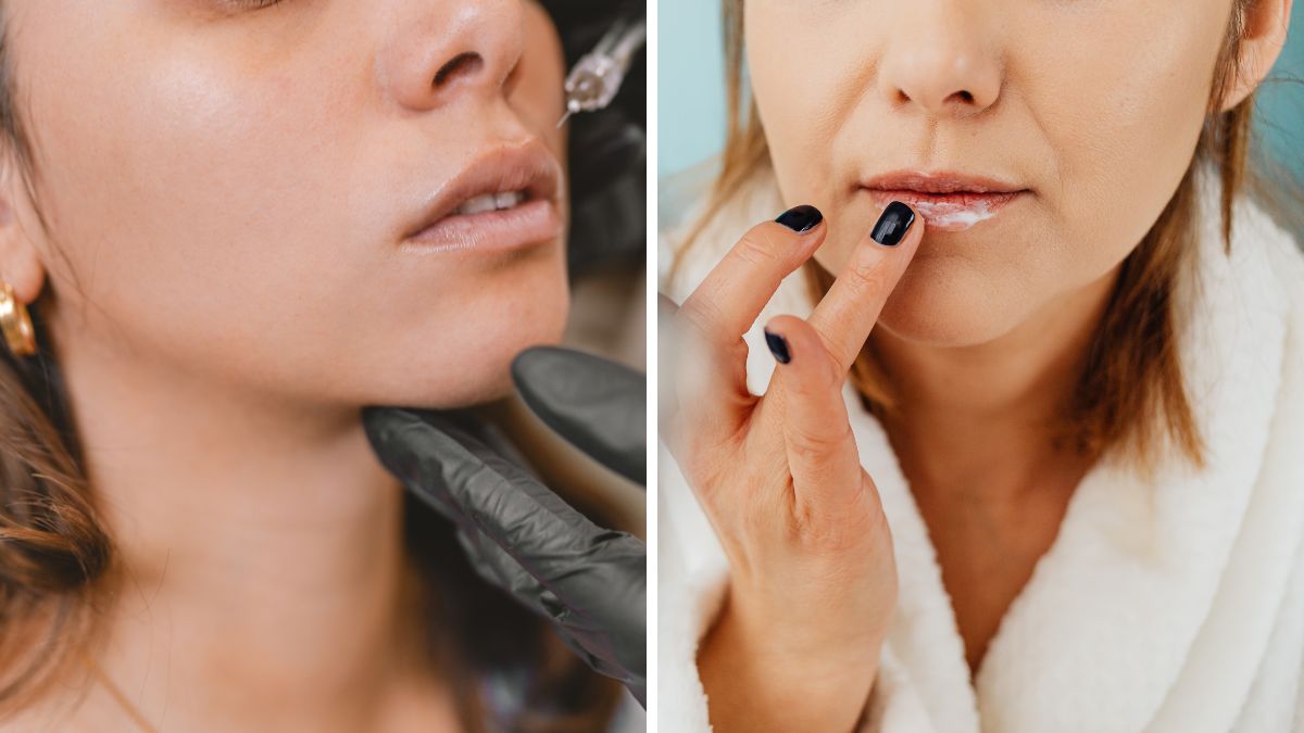Plastic Surgeon Explains What Happens When You Stop Getting Lip Fillers