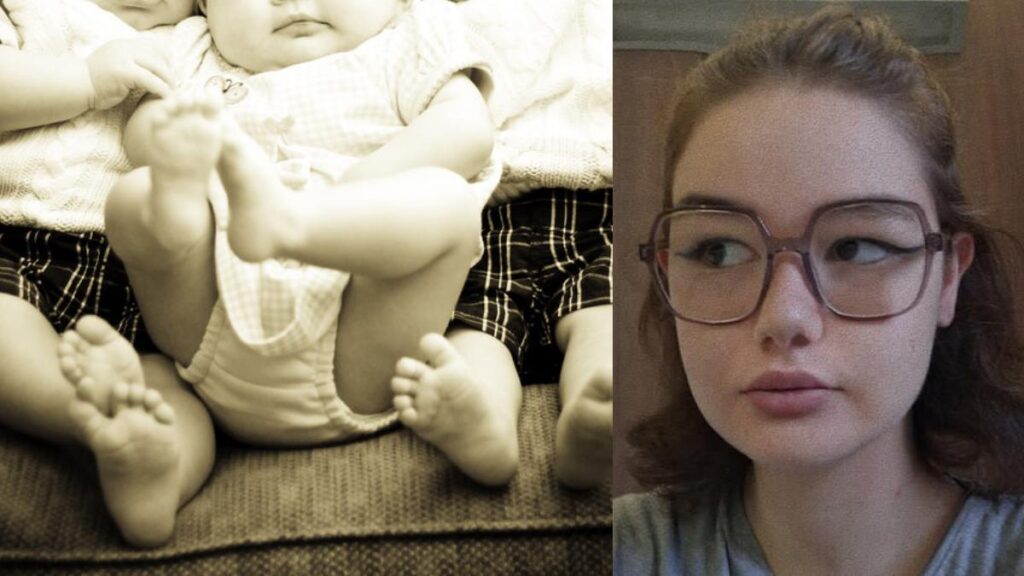 Clelia Verdier’s coma dream of triplets. (Image Credits-Openverse and The Daily Mail)