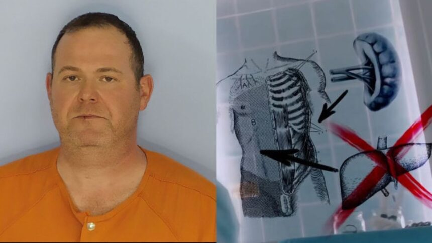 Florida surgeon removes liver instead of spleen, killing a patient.