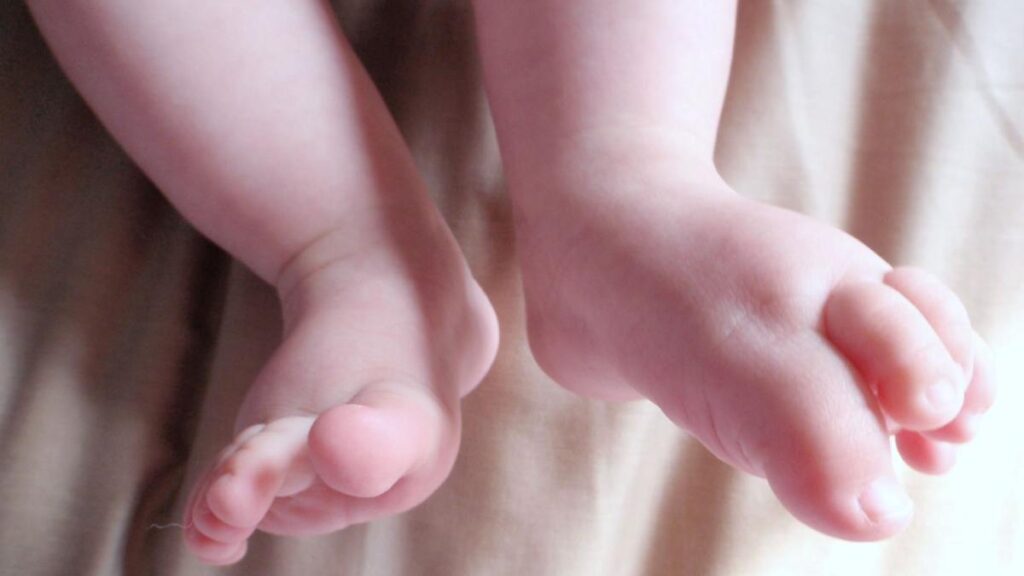 Orlando baby 'born twice' after pathbreaking surgery