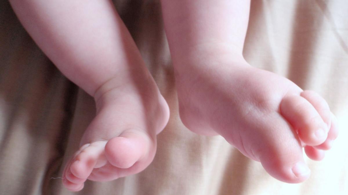 Orlando baby 'born twice' after pathbreaking surgery