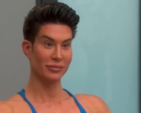 Cosmetologist in Shock as Patient Begs to Fix Botched Face After 25 Surgeries: ‘I’ve never seen anybody…’