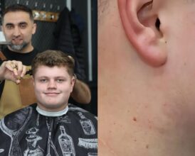 One Barber’s Tense Warning During Routine Haircut Led to Saving a Teenage Boy From Rare Cancer—’Do You Realise…’