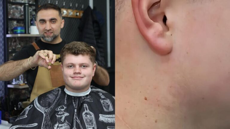 Barber’s haircut led to Hodgkin lymphoma, a cancer diagnosis. (Image Credits-@Fact Volt Stories/YouTube)