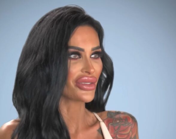 Doctors Rejected ‘Human Barbie’ for 1000cc Implants Plastic Surgery—And Her BMI Was Only Part of the Problem