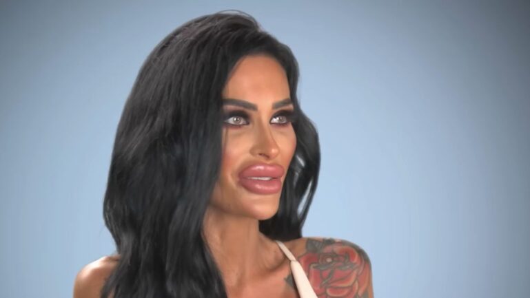 An Australian woman with plastic surgery addiction got rejected by Botched