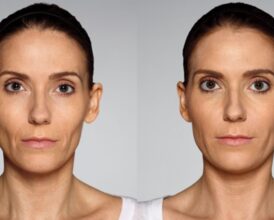 Woman Secretly Got Plastic Surgery—Her Husband’s One ‘Ultimate Goal’ Response Proves He Still Doesn’t Know