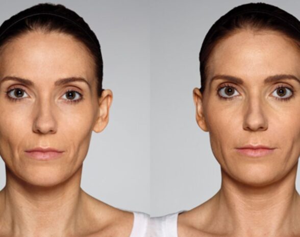 Woman Secretly Got Plastic Surgery—Her Husband’s One ‘Ultimate Goal’ Response Proves He Still Doesn’t Know