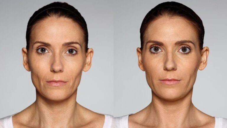 Reddit user fooled her husband with a subtle filler in her face