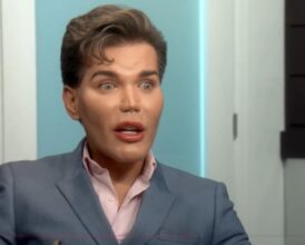 Patient’s Botched Plastic Surgery Complications Are ‘One of the Worst’ a Top Surgeon Has Seen—Doctor’s Warning Is Chilling