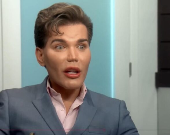 Patient’s Botched Plastic Surgery Complications Are ‘One of the Worst’ a Top Surgeon Has Seen—Doctor’s Warning Is Chilling
