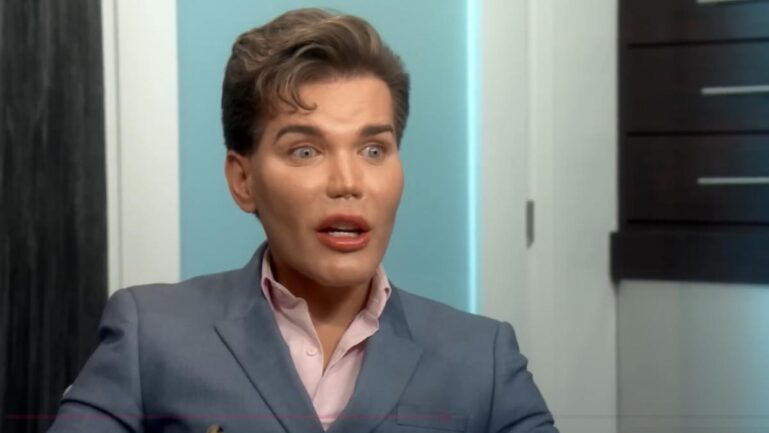 Rodrigo Alves speaks about his rhinoplasty complications while seeking plastic surgery medical help. (Image Credits- Botched/YouTube)