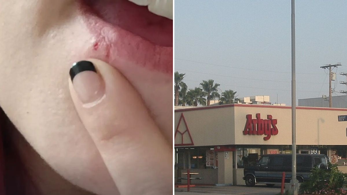 Arby's Security Footage Outs Shift Manager After Drive-Thru Dispute Ends in Herpes Transmission—'I Couldn't Get a Kiss…'